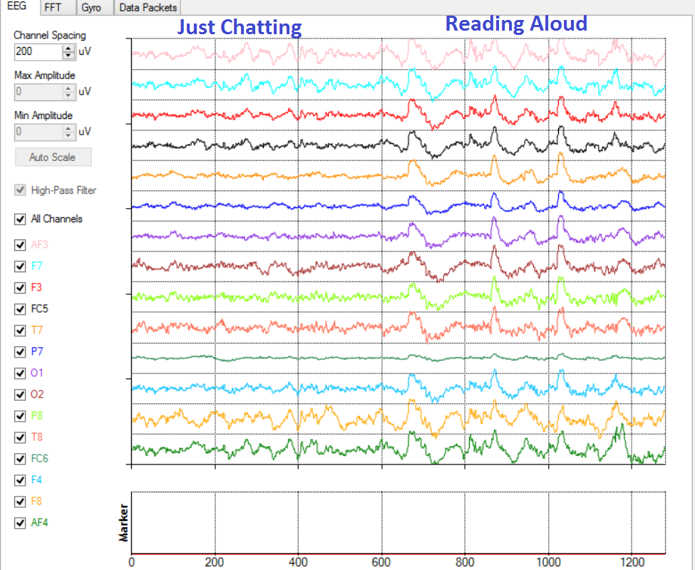 EEG trace of a non-Dyslexic